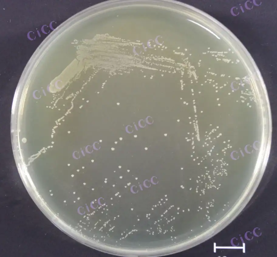 How Akkermansia muciniphila Boosts Gut Health?